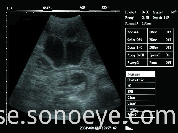 v5 pet ultrasound